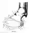 Fig. 02 - Hoof balancer and limb alignment tool