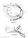 Fig. 06 - Hoof balancer and limb alignment tool