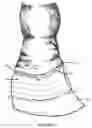 Fig. 08 - Hoof balancer and limb alignment tool