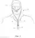 Fig. 02 - Nasal ventilation interface