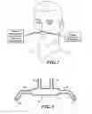 Fig. 02 - Multipurpose cannula