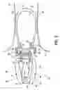 Fig. 03 - Self-fitting device for location in an ear canal
