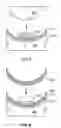 Fig. 07 - Polarized lens and method of making polarized lens