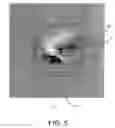 Fig. 06 - Method and apparatus for improved display of digital mammographic images