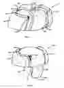 Fig. 07 - Headgear for docking and listening to portable audio devices
