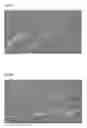 Fig. 06 - COMPOSITION FOR TREATING DAMAGE OF CENTRAL OR PERIPHERAL NERVE SYSTEM