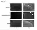 Fig. 22 - COMPOSITION FOR TREATING DAMAGE OF CENTRAL OR PERIPHERAL NERVE SYSTEM