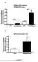 Fig. 04 - Method for treating amyloid disease