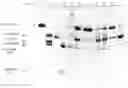 Fig. 01 - Removal of plasmin or plasminogen from cryoprecipitate