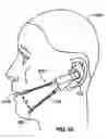 Fig. 09 - Two-Way Communication Device with Detachable Boom
