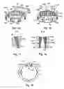 Fig. 08 - Torque transmission device useful as a fixed constant velocity ball joint for drive shafts and method for producing such a joint