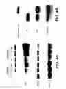 Fig. 09 - Androgen-regulated PMEPA1 gene and polypeptides
