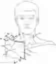 Fig. 01 - Sleep apnea prevention and relief device