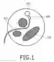 Fig. 02 - SURGICAL NEEDLE AND METHOD OF GUIDING A SURGICAL NEEDLE