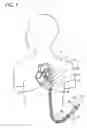 Fig. 02 - Catheter Drug Delivery System and Method for Use