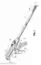 Fig. 02 - Staple with Multiple Cross Sectional Shapes