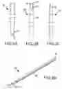 Fig. 03 - Methods and apparatus for accessing and treating the facet joint
