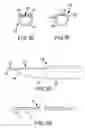 Fig. 04 - Methods and apparatus for accessing and treating the facet joint