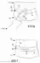 Fig. 06 - Methods and apparatus for accessing and treating the facet joint