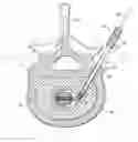 Fig. 01 - INSTRUMENTS, IMPLANTS, AND METHODS FOR FIXATION OF VERTEBRAL COMPRESSION FRACTURES