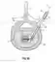 Fig. 03 - INSTRUMENTS, IMPLANTS, AND METHODS FOR FIXATION OF VERTEBRAL COMPRESSION FRACTURES