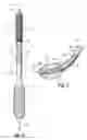 Fig. 04 - INSTRUMENTS, IMPLANTS, AND METHODS FOR FIXATION OF VERTEBRAL COMPRESSION FRACTURES
