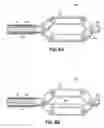 Fig. 07 - INSTRUMENTS, IMPLANTS, AND METHODS FOR FIXATION OF VERTEBRAL COMPRESSION FRACTURES
