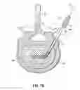Fig. 09 - INSTRUMENTS, IMPLANTS, AND METHODS FOR FIXATION OF VERTEBRAL COMPRESSION FRACTURES