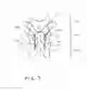 Fig. 08 - Spinal tension band