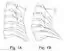 Fig. 02 - CERVICAL SPINE IMPLANT SYSTEM AND METHOD