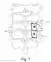 Fig. 09 - CERVICAL SPINE IMPLANT SYSTEM AND METHOD