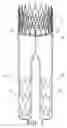 Fig. 02 - Low profile medical device