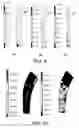 Fig. 09 - IMPLANTABLE BIOMIMETIC PROSTHETIC BONE