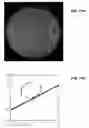 Fig. 52 - Ion sources, systems and methods