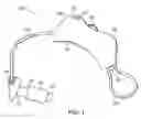 Fig. 02 - Hearing aid