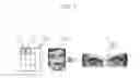 Fig. 10 - Method and system for image restoration using frequency-based image model