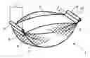 Fig. 01 - Enhanced Plastic Net Bag