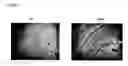 Fig. 06 - VDCC Gamma-8 Ion Channel