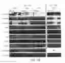 Fig. 18 - Mesoderm And Definitive Endoderm Cell Populations