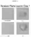 Fig. 02 - Methods and compositions for treating keratin hyperproliferative disorders