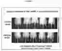 Fig. 09 - Methods and compositions for treating keratin hyperproliferative disorders