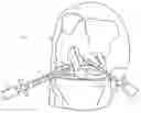 Fig. 01 - Atraumatic arthroscopic instrument sheath