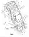 Fig. 02 - Knee immobilizer