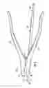 Fig. 02 - Expansion and compression instrument for fracture fixation