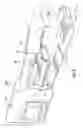 Fig. 04 - THERMAL SUTURE WELDING APPARATUS AND METHOD