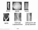 Fig. 02 - PROMOTER MOLECULES FOR USE IN PLANTS
