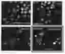 Fig. 01 - Method for determination and quantification of radiation or genotoxin exposure