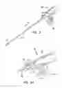 Fig. 04 - APPARATUS AND METHOD FOR ACHIEVING MICROPUNCTURE