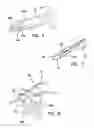 Fig. 05 - APPARATUS AND METHOD FOR ACHIEVING MICROPUNCTURE