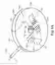 Fig. 07 - Burr hole anchors, systems, and methods